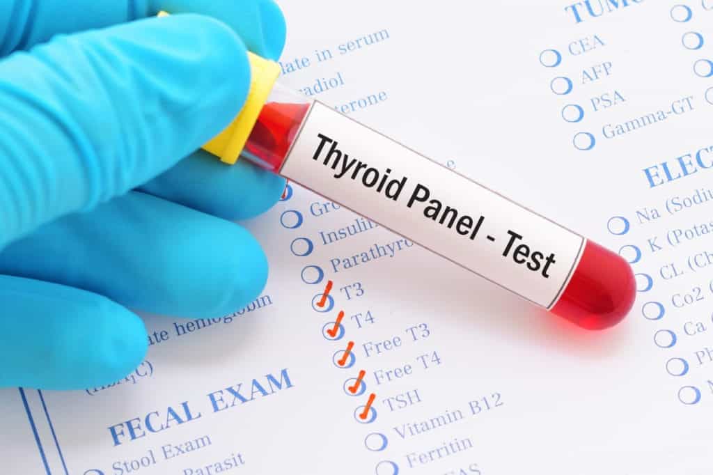 Thyroid Panel Test to Test Thyroid Health | Burt's Pharmacy and Compounding Lab