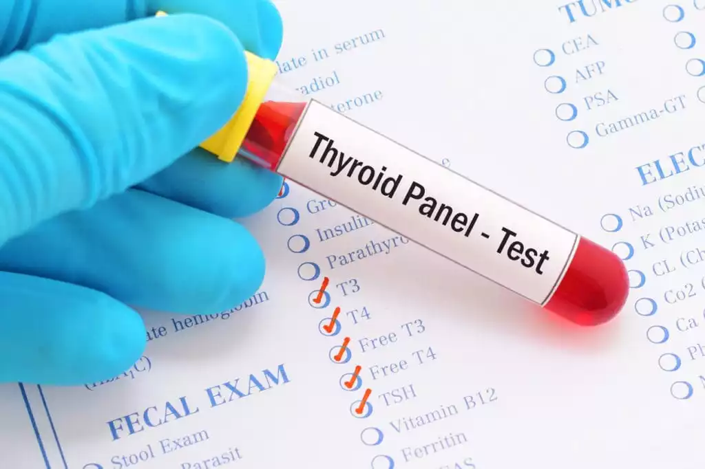 Thyroid Panel Test to Test Thyroid Health | Burt's Pharmacy and Compounding Lab