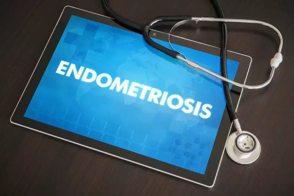 Endometriosis | Burt's Pharmacy and Compounding Lab