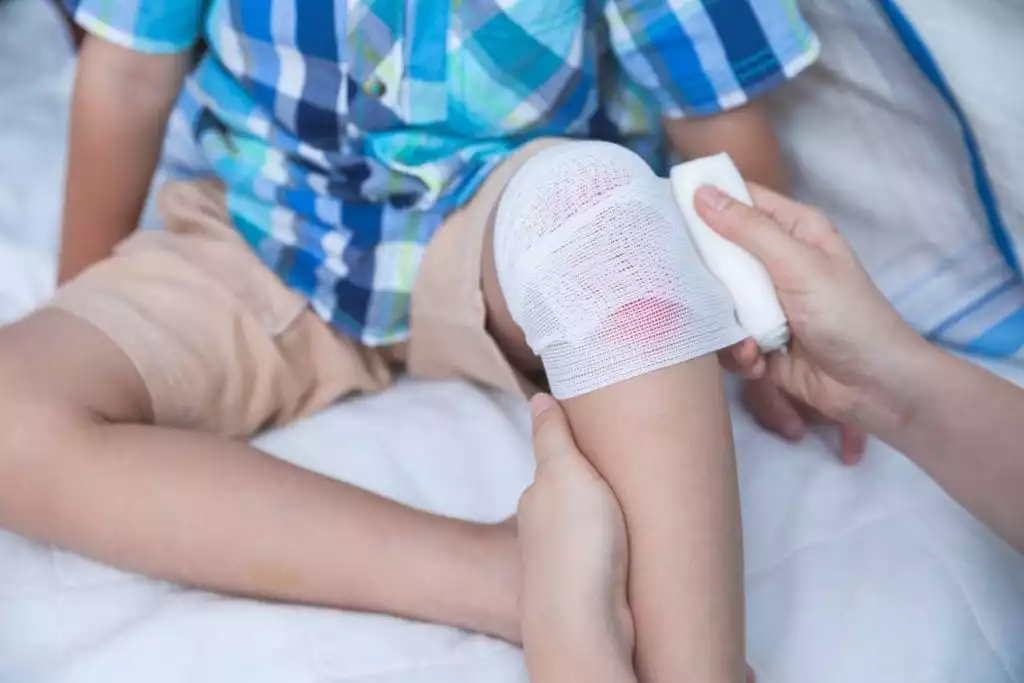 Pediatric Wound Care for Kids This Summer | Burt's Pharmacy and Compounding Lab