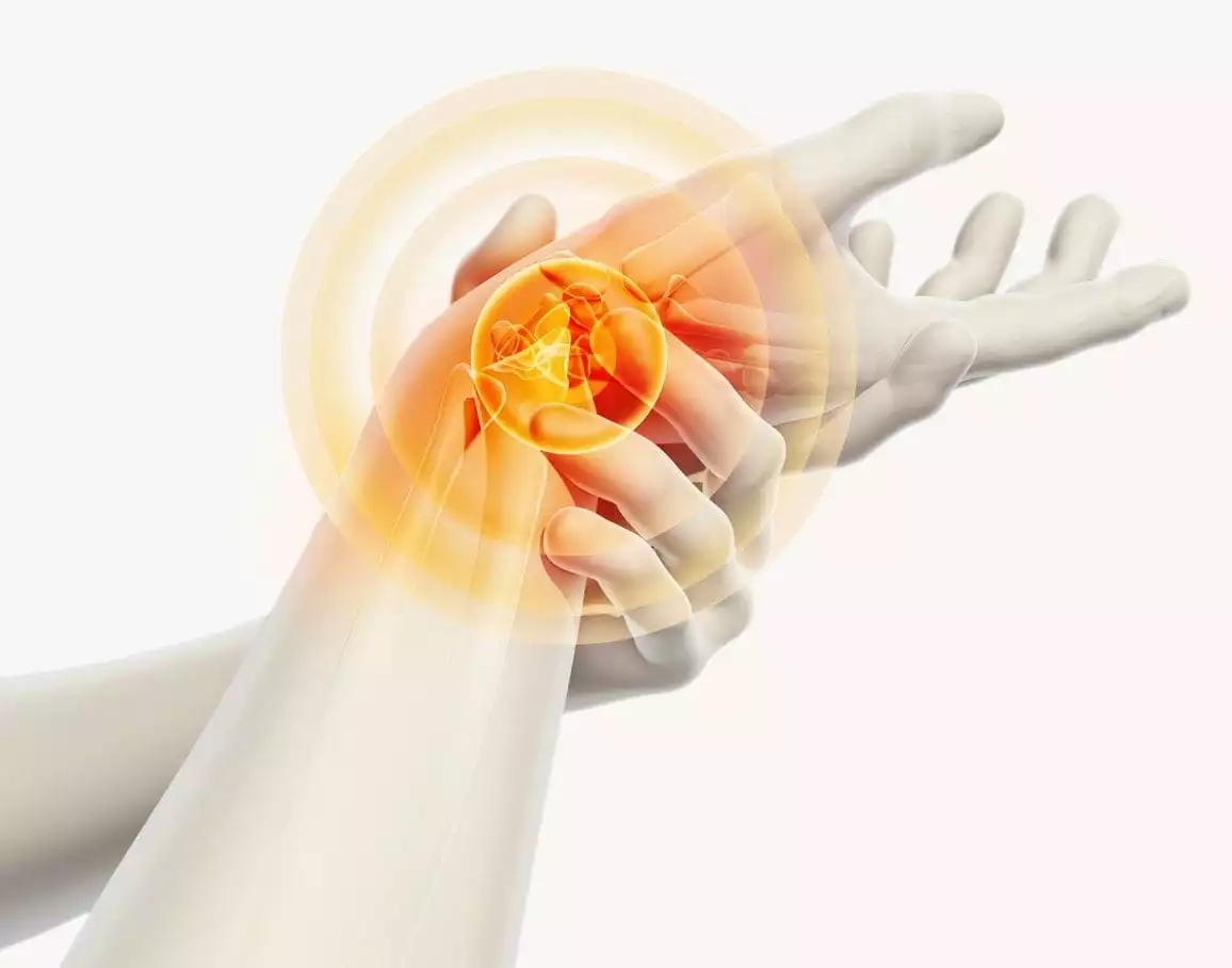Arthritis in Wrist | Burt's Pharmacy and Compounding Lab