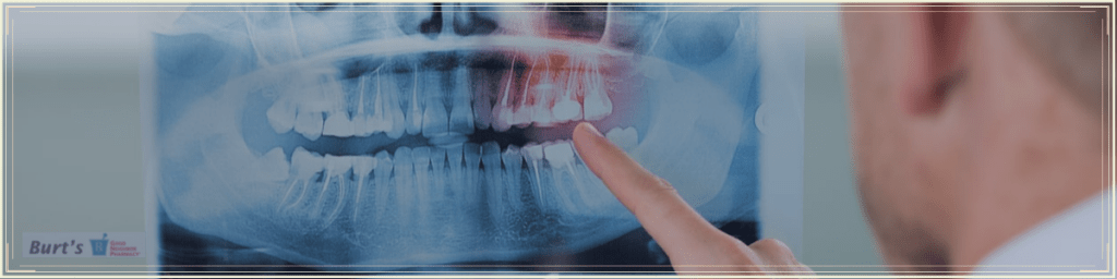 Dental Hygiene Stages of Gum Disease and Treatment Options - Burt's Pharmacy and Compounding Lab