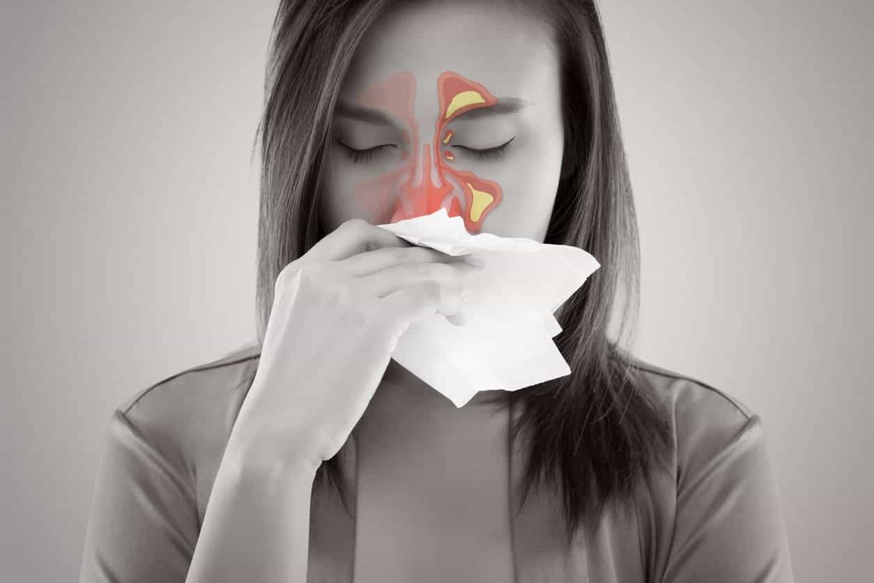 鼻窦炎最佳治疗？鼻窦炎的症状及治疗 - 知乎