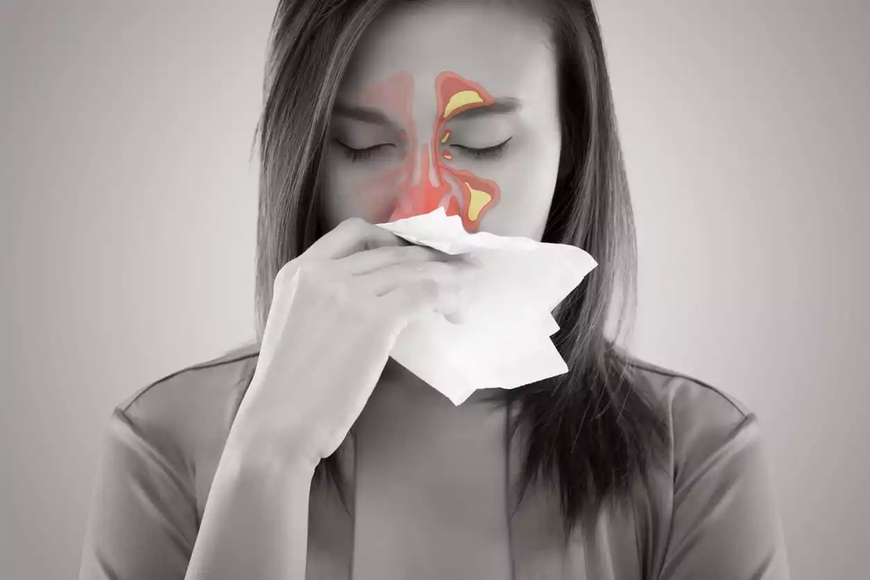 Woman Suffering from Sinus Pain - Burt's Pharmacy and Compounding Lab