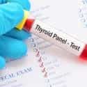 Thyroid Treatment and Tests - Burt's Pharmacy and Compounding Lab