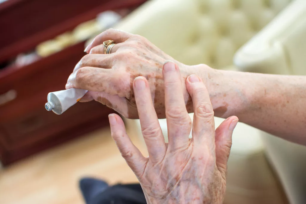 Managing Arthritis With the Help of Compounded Medications - Burt's Pharmacy and Compounding Lab